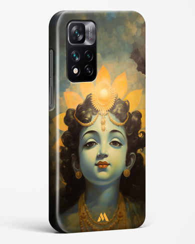 Krishna Serenade Hard Case Phone Cover (Xiaomi)