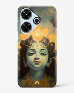 Krishna Serenade Hard Case Phone Cover (Xiaomi)