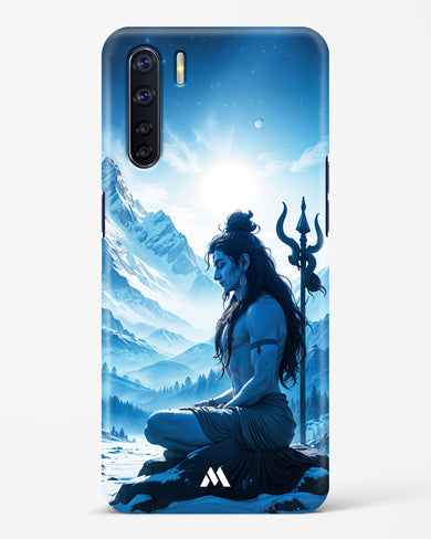 Meditating on Kailash Hard Case Phone Cover (Oppo)