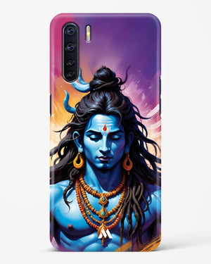 Shiva in Penance Hard Case Phone Cover (Oppo)