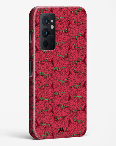 Ope Ope Devil Fruit Hard Case Phone Cover (OnePlus)