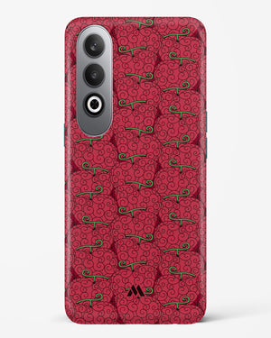 Ope Ope Devil Fruit Hard Case Phone Cover (OnePlus)