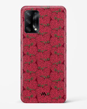 Ope Ope Devil Fruit Hard Case Phone Cover (Oppo)