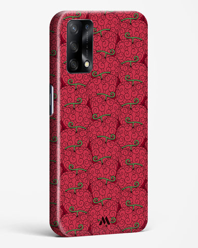 Ope Ope Devil Fruit Hard Case Phone Cover (Oppo)