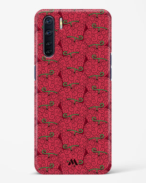 Ope Ope Devil Fruit Hard Case Phone Cover (Oppo)