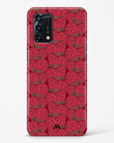 Ope Ope Devil Fruit Hard Case Phone Cover (Oppo)