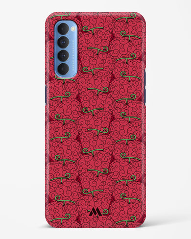 Ope Ope Devil Fruit Hard Case Phone Cover (Oppo)