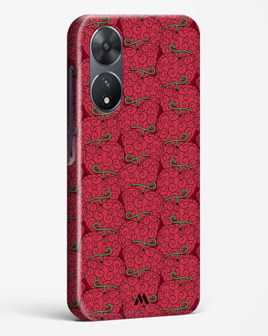 Ope Ope Devil Fruit Hard Case Phone Cover (Vivo)