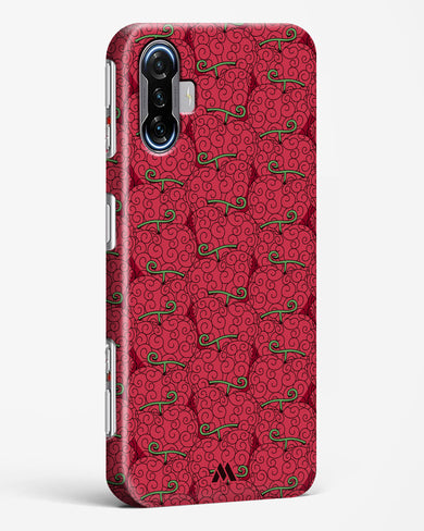 Ope Ope Devil Fruit Hard Case Phone Cover (Xiaomi)