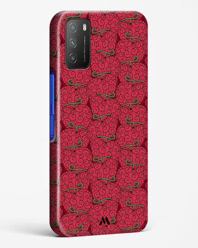 Ope Ope Devil Fruit Hard Case Phone Cover (Xiaomi)