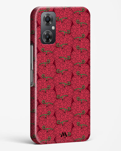 Ope Ope Devil Fruit Hard Case Phone Cover (Xiaomi)