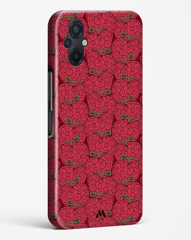 Ope Ope Devil Fruit Hard Case Phone Cover (Xiaomi)