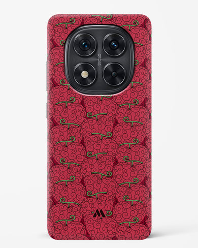 Ope Ope Devil Fruit Hard Case Phone Cover (Xiaomi)