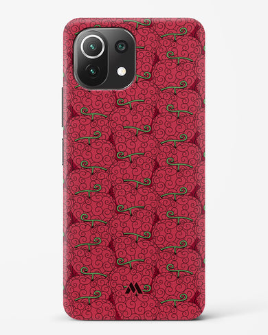 Ope Ope Devil Fruit Hard Case Phone Cover (Xiaomi)