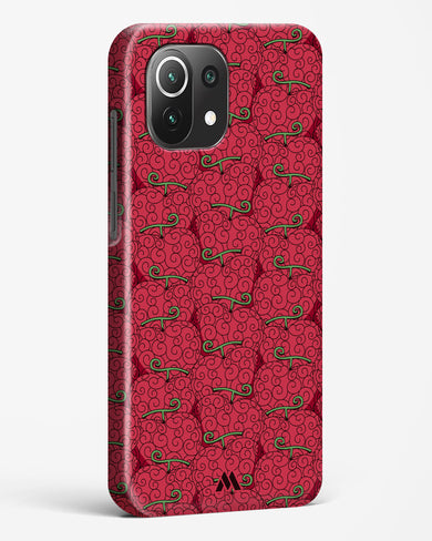 Ope Ope Devil Fruit Hard Case Phone Cover (Xiaomi)