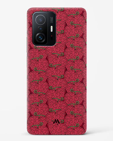 Ope Ope Devil Fruit Hard Case Phone Cover (Xiaomi)