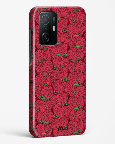 Ope Ope Devil Fruit Hard Case Phone Cover (Xiaomi)