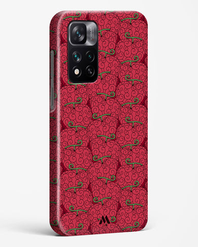 Ope Ope Devil Fruit Hard Case Phone Cover (Xiaomi)