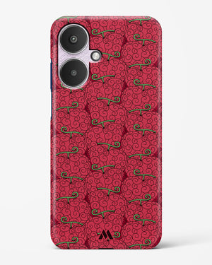 Ope Ope Devil Fruit Hard Case Phone Cover (Xiaomi)