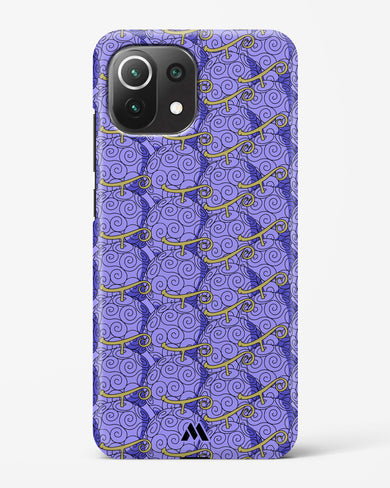 Gomu Gomu Devil Fruit Hard Case Phone Cover (Xiaomi)