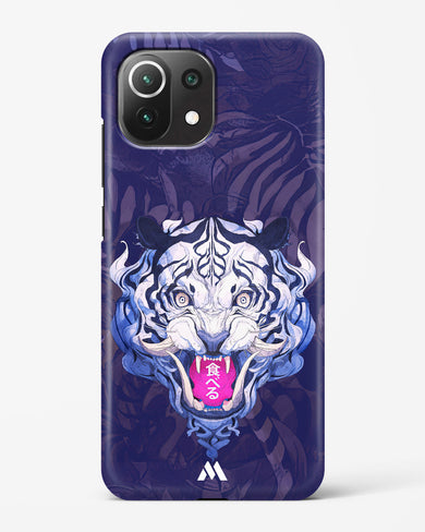 Tiger Tantrum Hard Case Phone Cover (Xiaomi)