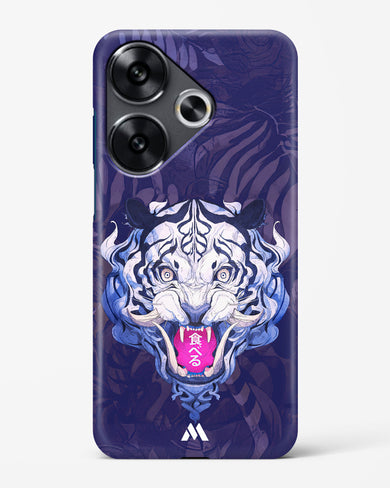 Tiger Tantrum Hard Case Phone Cover (Xiaomi)