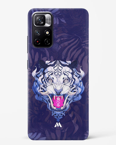 Tiger Tantrum Hard Case Phone Cover (Xiaomi)