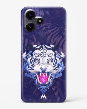 Tiger Tantrum Hard Case Phone Cover (Xiaomi)