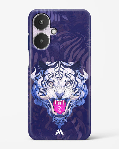 Tiger Tantrum Hard Case Phone Cover (Xiaomi)