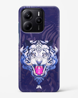 Tiger Tantrum Hard Case Phone Cover (Xiaomi)