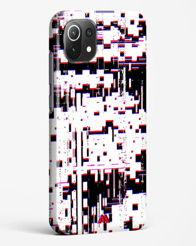 Glitch in the Code Hard Case Phone Cover (Xiaomi)