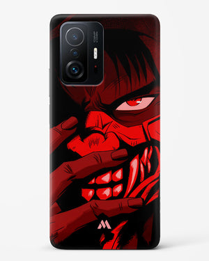 Ninja Kamui Hard Case Phone Cover (Xiaomi)