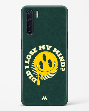 Losing My Mind Hard Case Phone Cover (Oppo)