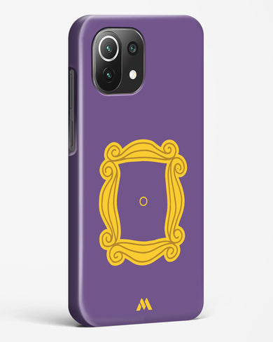 Friends Frame Hard Case Phone Cover (Xiaomi)