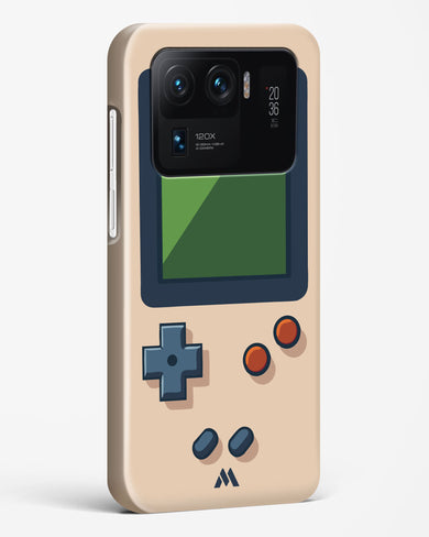 Vintage Gameboy Hard Case Phone Cover (Xiaomi)
