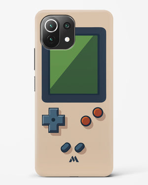 Vintage Gameboy Hard Case Phone Cover (Xiaomi)