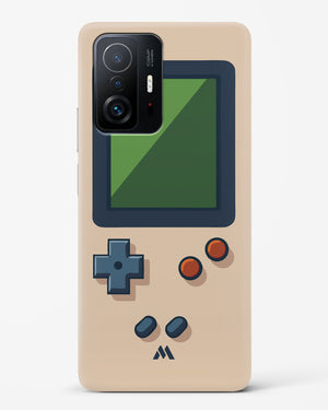 Vintage Gameboy Hard Case Phone Cover (Xiaomi)