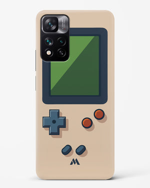 Vintage Gameboy Hard Case Phone Cover (Xiaomi)