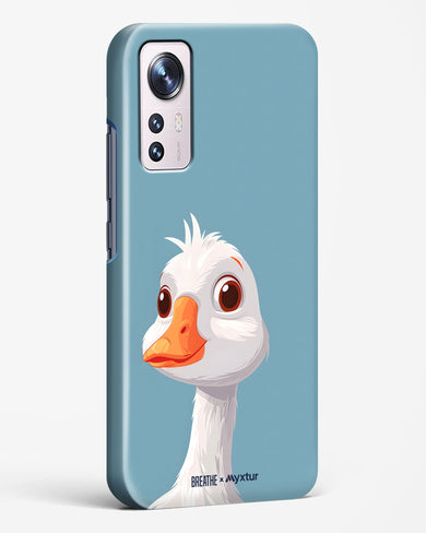 Duck Duck Go [BREATHE] Hard Case Phone Cover (Xiaomi)