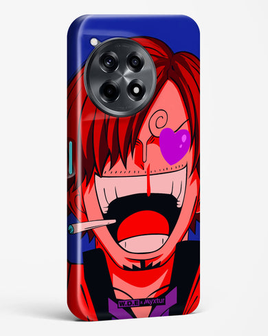 Pirate Cook [WDE] Hard Case Phone Cover (OnePlus)