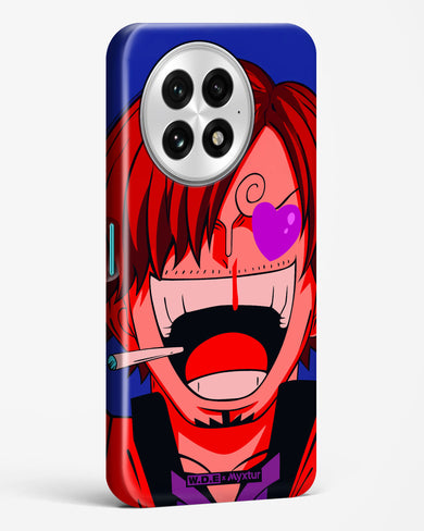 Pirate Cook [WDE] Hard Case Phone Cover (OnePlus)