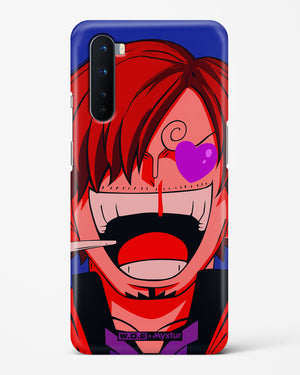 Pirate Cook [WDE] Hard Case Phone Cover (OnePlus)