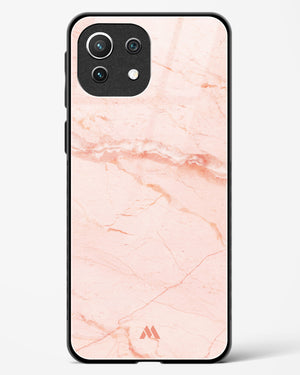 Rose Quartz on Marble Glass Case Phone Cover (Xiaomi)