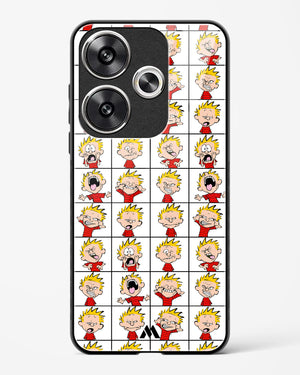 Calvin Making Faces Glass Case Phone Cover (Xiaomi)