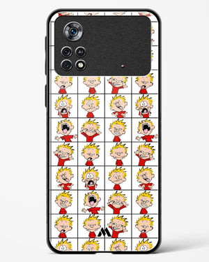 Calvin Making Faces Glass Case Phone Cover (Xiaomi)