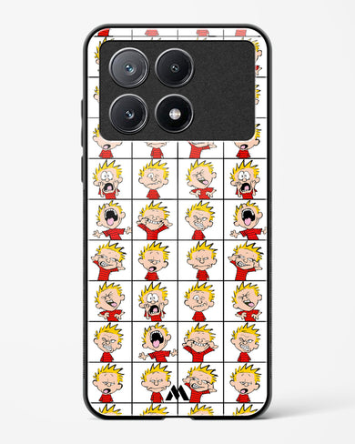 Calvin Making Faces Glass Case Phone Cover-(Xiaomi)