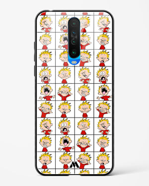 Calvin Making Faces Glass Case Phone Cover (Xiaomi)