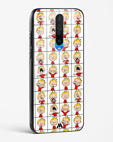 Calvin Making Faces Glass Case Phone Cover (Xiaomi)
