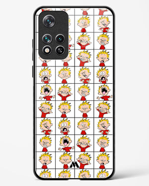 Calvin Making Faces Glass Case Phone Cover (Xiaomi)
