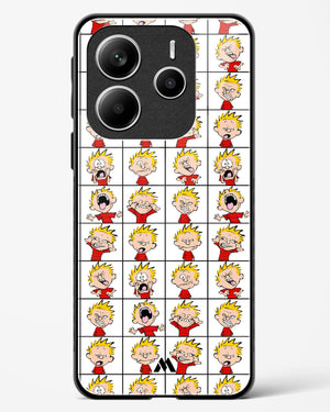 Calvin Making Faces Glass Case Phone Cover (Xiaomi)